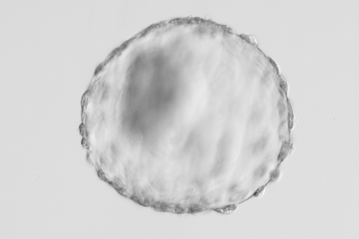 [#if coverImage??]
    [#if coverImage?is_hash]
        [#if coverImage.alt??]
            ${coverImage.alt}
        [/#if]
    [/#if]
[/#if]